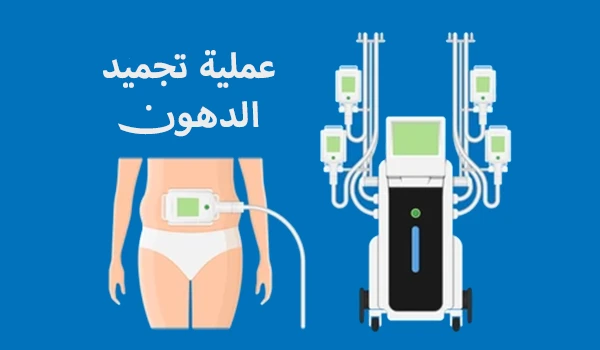 عملية تجميد الدهون (الكرايو) بديل آمن شفط الدهون الآمن؟