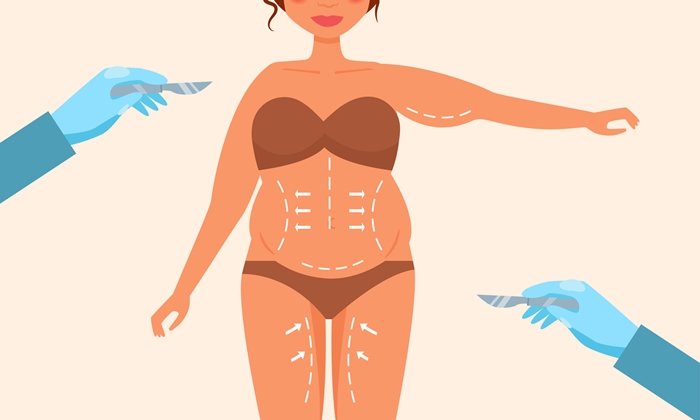 ما هي عملية شد الجسم؟