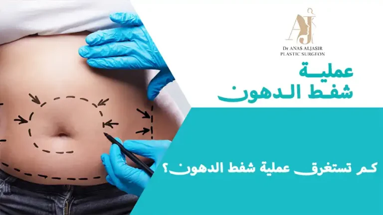 كم تستغرق عملية شفط الدهون؟ كل ما تحتاج معرفته قبل الإجراء