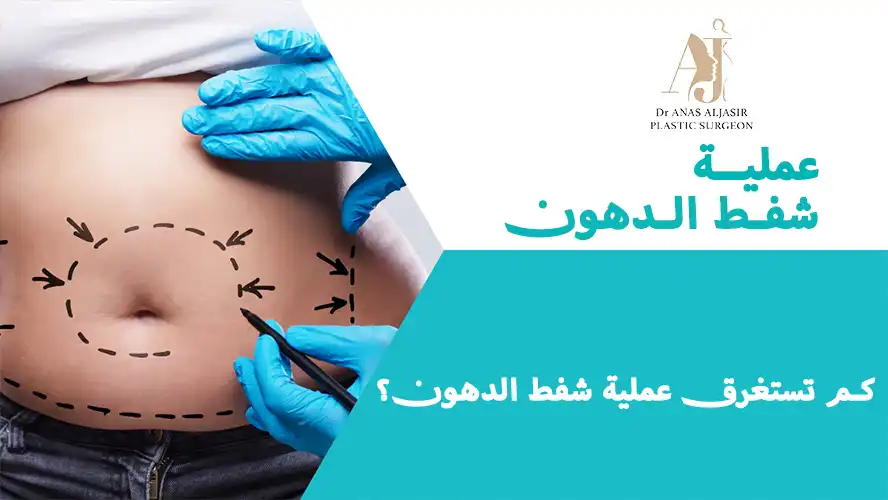 كم تستغرق عملية شفط الدهون؟ كل ما تحتاج معرفته قبل الإجراء