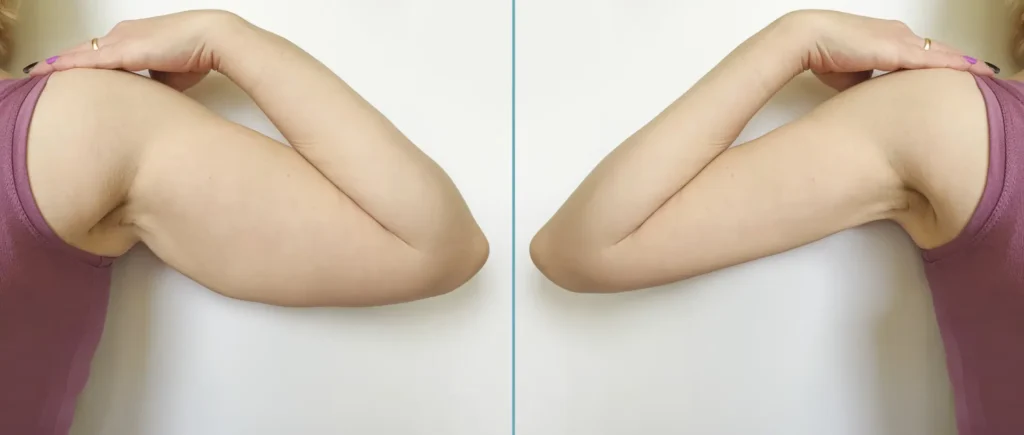 كيف تُقلل عيادة الدكتور أنس الجاسر من ظهور الندوب؟