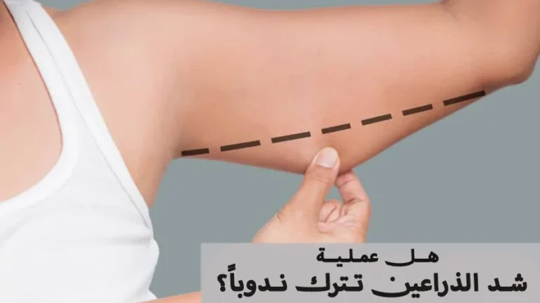 هل عملية شد الذراعين تترك ندوباً؟ نصائح لتجنب الآثار الظاهرة