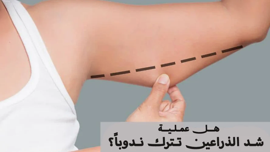 هل عملية شد الذراعين تترك ندوباً؟ نصائح لتجنب الآثار الظاهرة