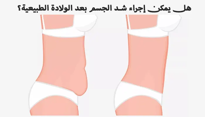 هل يمكن إجراء شد الجسم بعد الولادة الطبيعية؟