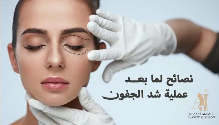 5 نصائح لما بعد عملية تجميل شد الجفون