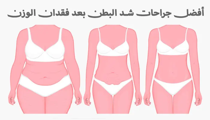 أفضل جراحات شد البطن بعد فقدان الوزن: الأسعار والنتائج والتجارب