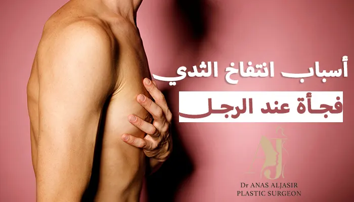 أسباب انتفاخ الثدي فجأة عند الرجل