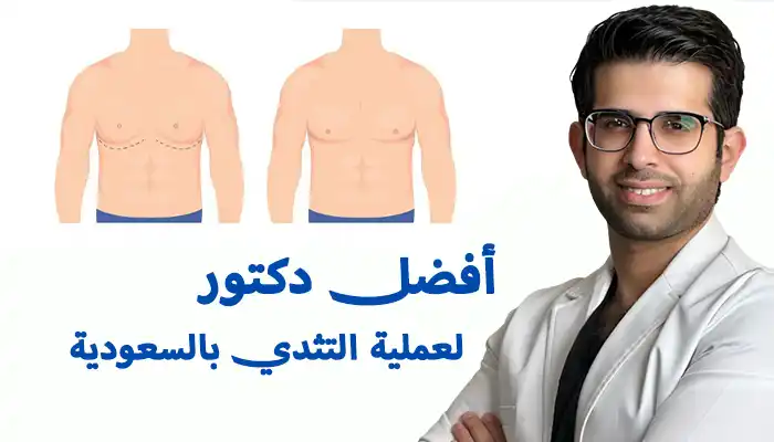 أفضل دكتور لعملية التثدي بالسعودية