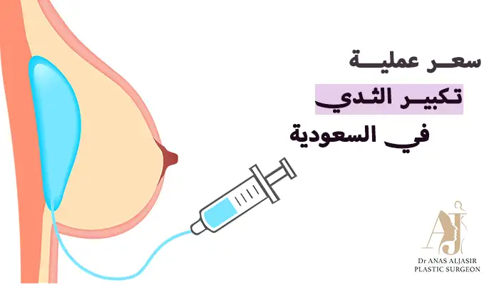 سعر عملية تكبير الثدي السعودية
