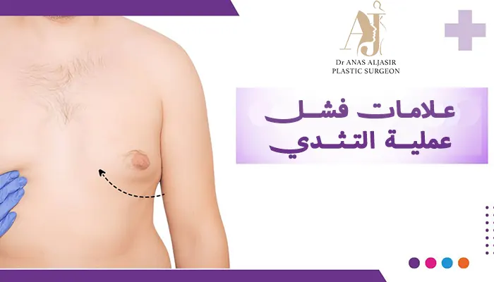 علامات فشل عملية التثدي