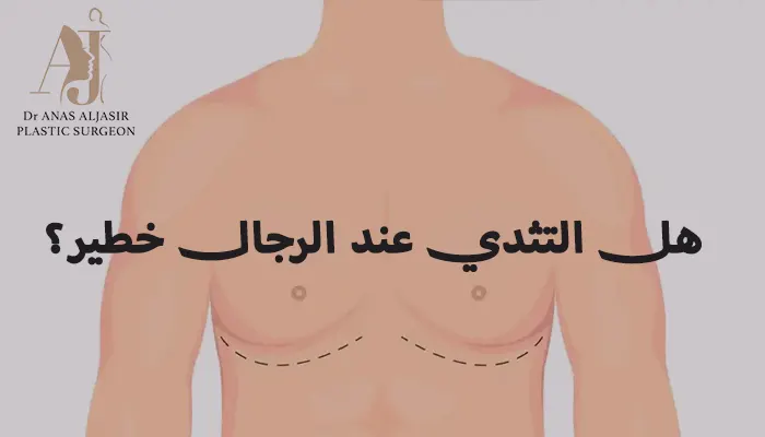 هل التثدي عند الرجال خطير؟