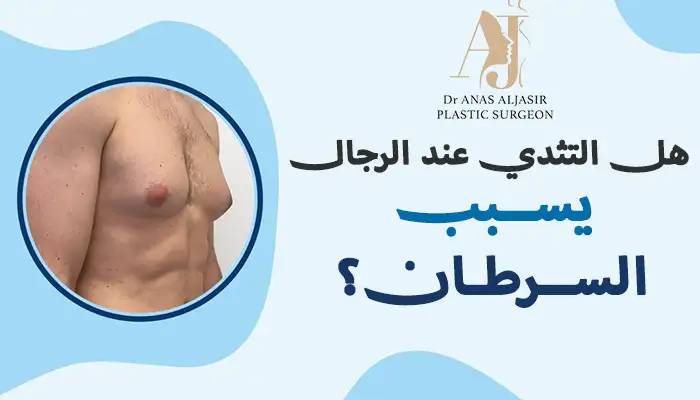 هل التثدي عند الرجال يسبب السرطان؟