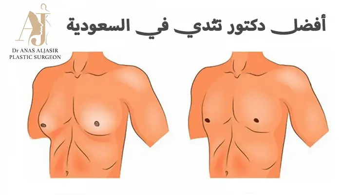 افضل دكتور تثدي في السعودية