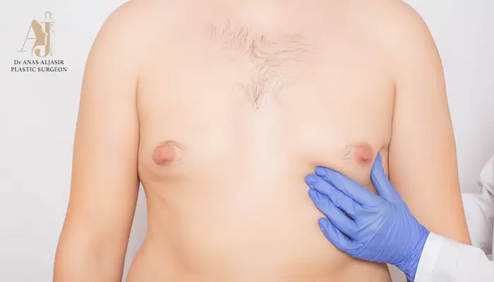 4 أسباب تدفع الرجال لاختيار عملية التثدي