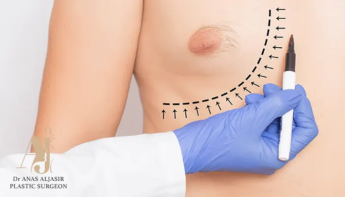 سعر عملية التثدي عند الرجال بالرياض