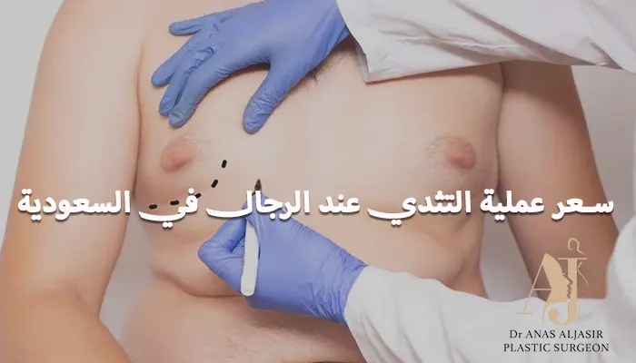 سعر عملية التثدي عند الرجال في السعودية
