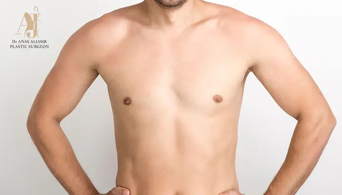 عملية التثدي باستخدام تقنية شفط الدهون بالفيزر