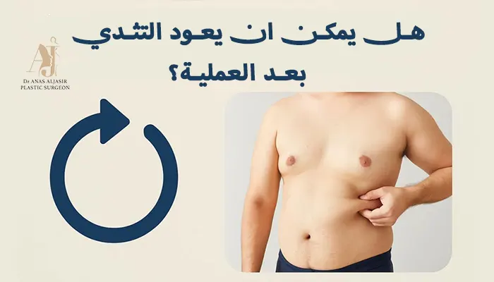 هل يمكن ان يعود التثدي بعد العملية؟