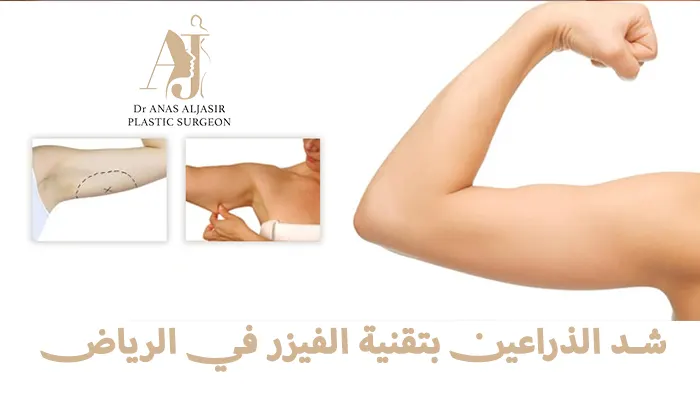 شد الذراعين بتقنية الفيزر في الرياض