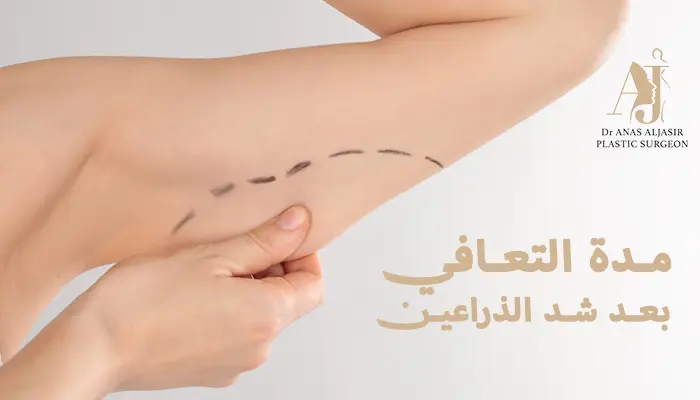 مدة التعافي بعد شد الذراعين