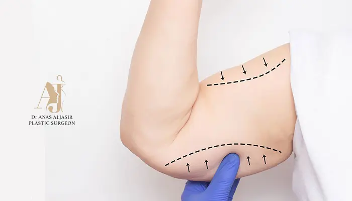 نصائح للتعافي بعد شد الذراعين بسرعة