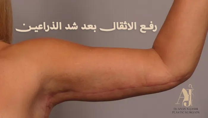 رفع الاثقال بعد شد الذراعين