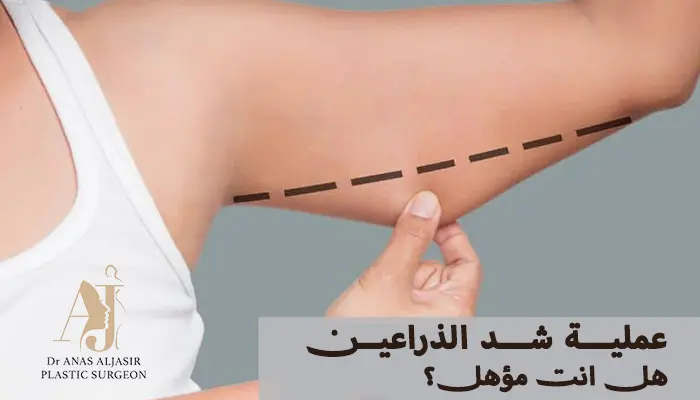 هل أنت مؤهل لعملية شد الذراعين؟