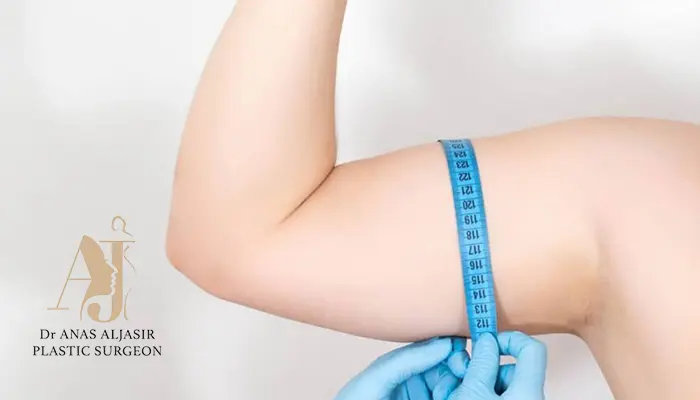 توقعات عملية شد الذراعين أثناء فترة التعافي