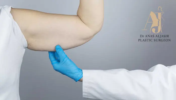 فهم جراحة شد الذراعين: الفوائد والإجراءات والتعافي