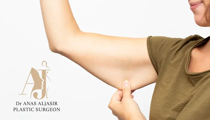 اسباب ترهلات الذراعين