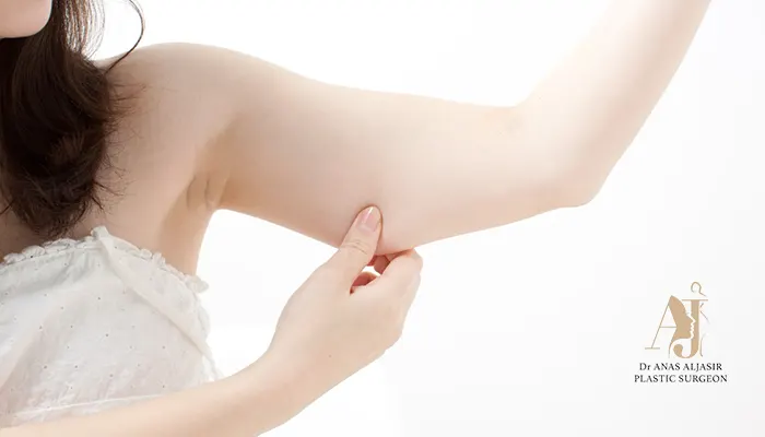 تجربتي مع عملية شد الزنود