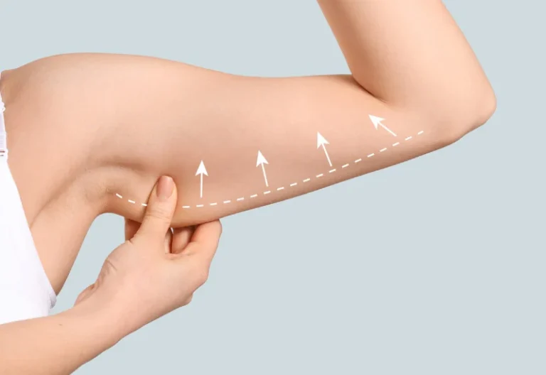 شد الذراعين بالرياض بدون جراحة