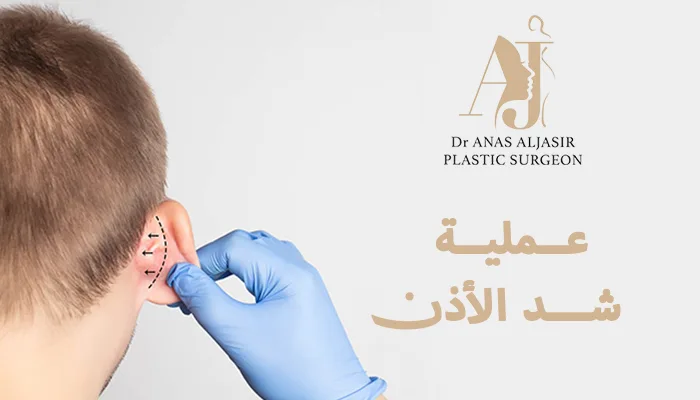 عملية شد الأذن