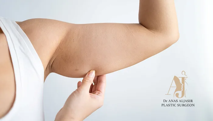 أفضل مركز لشد ترهلات الذراعين