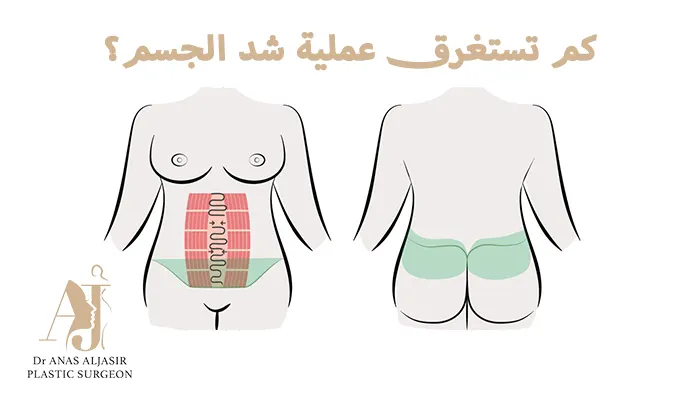 كم تستغرق عملية شد الجسم؟