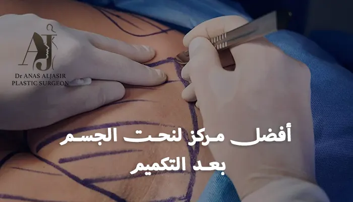 أفضل مركز لنحت الجسم بعد التكميم بالرياض