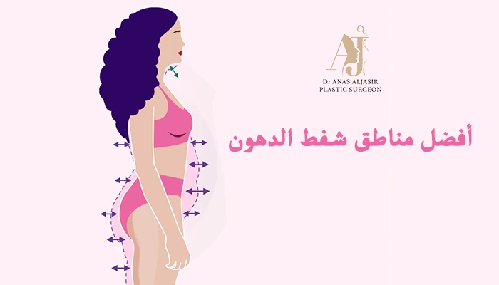 أفضل مناطق شفط الدهون