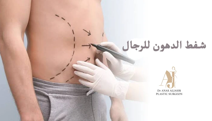 شفط الدهون للرجال