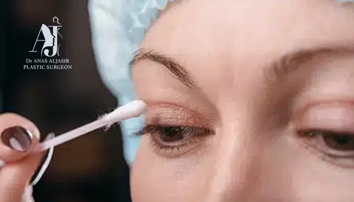 غسل الوجه بعد عملية شد الجفون