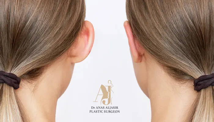 تجميل الأذن البارزة للحصول على مظهر متناسق وطبيعي
