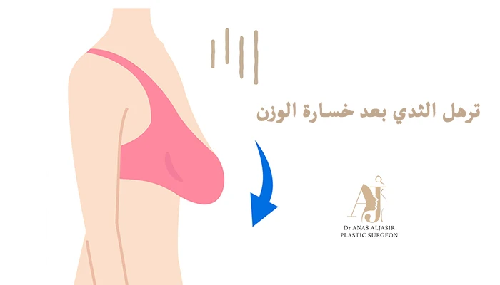 لماذا يترهل الثدي بعد خسارة الوزن؟